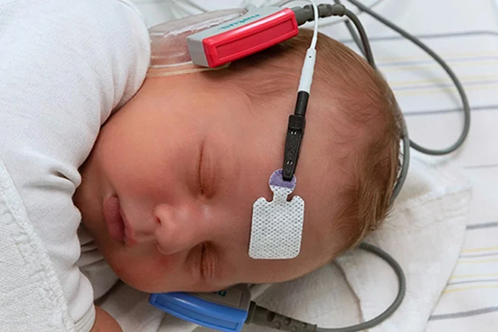 Newborn Hearing Screening